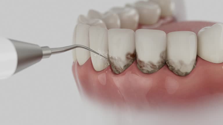 Trusted Wisdom Tooth Removal service in Fairbanks, AK - Dentist Open Now